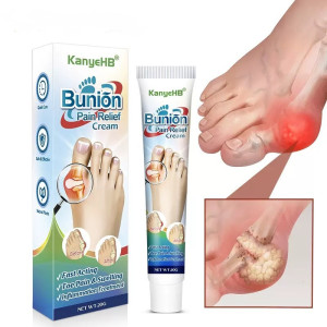 КРЕМ ОТ КОСТОЧКИ НА НОГЕ (HALLUX VALGUS) Bunion Pain Relief Cream — комфорт, лёгкость и забота о ваших ногах каждый день